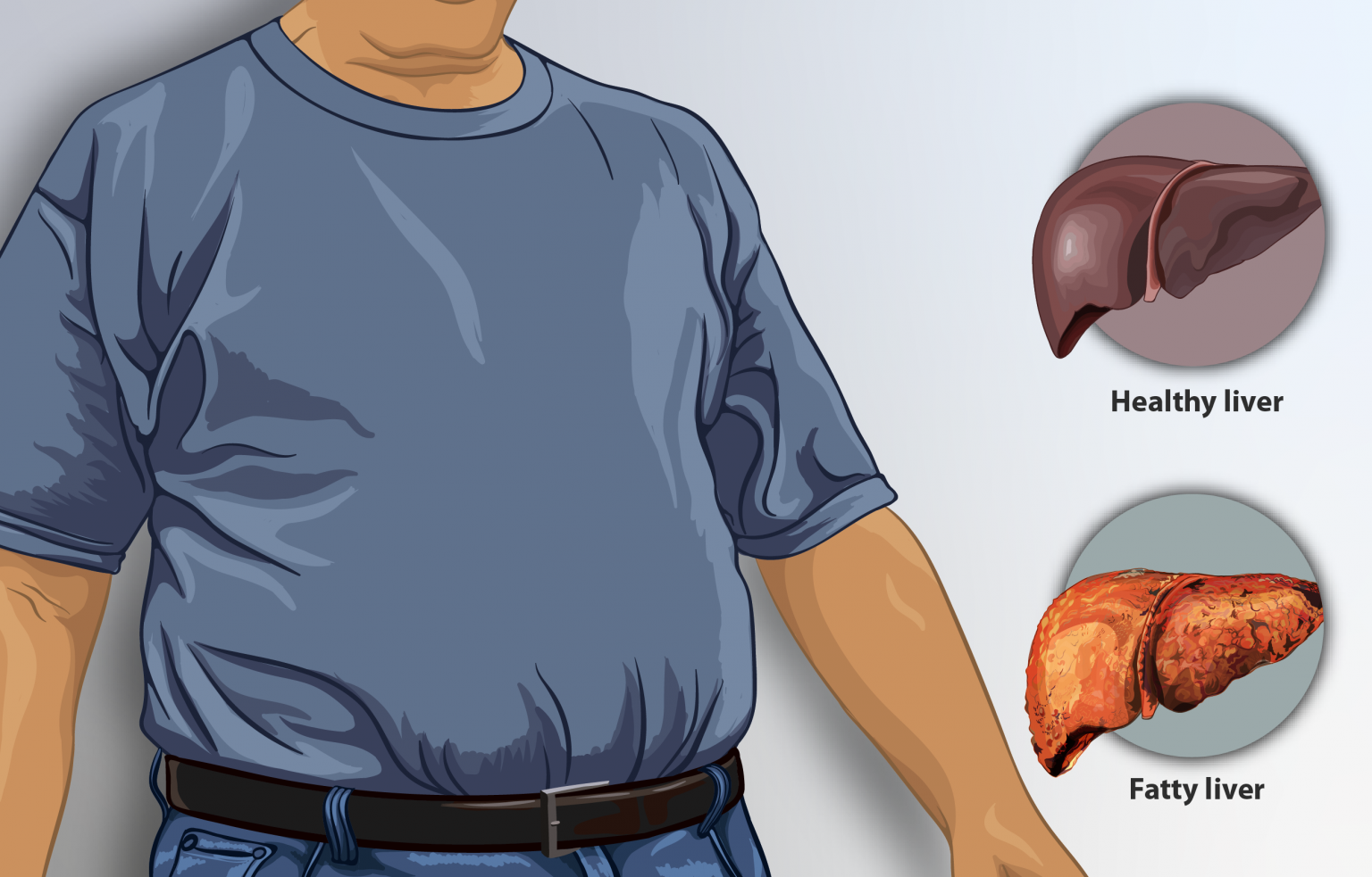 Your Liver and Marijuana: 11 Things Everyone Needs to Know - Marijuana